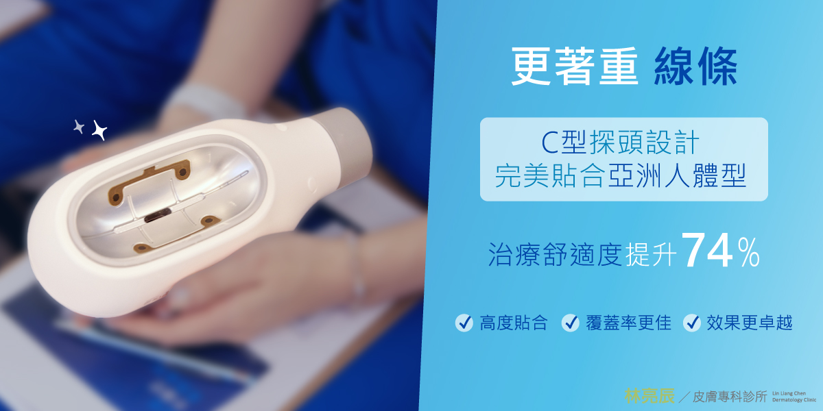 CoolSculpting Elite 酷塑冷凍減脂探頭曲線更貼合亞洲人