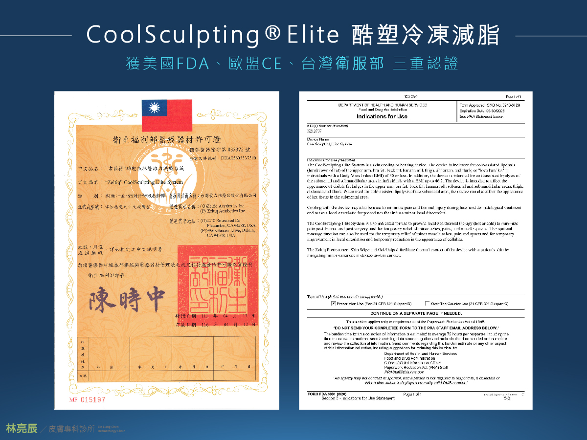 CoolSculpting酷塑冷凍減脂獲得美國FDA歐盟CE、台灣TFDA三重認證