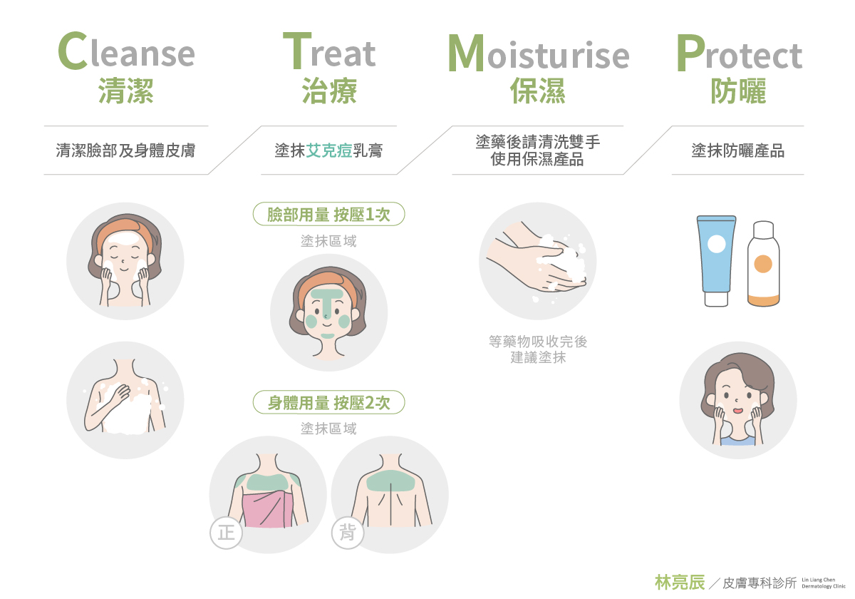 青春痘治療計畫—清潔(Cleanse) / 治療(Treat) / 保濕(Moisturise) / 防曬(Protect)