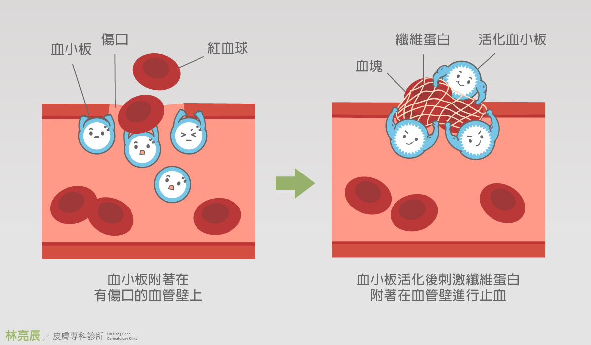 PLT凍晶源自血小板 血小板則有修復功能