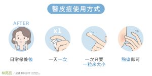 醫皮痘使用方式、醫皮痘怎麼擦