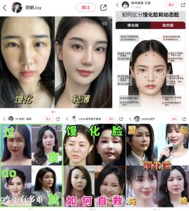 近年來饅化臉一詞在小紅書相當熱議。但什麼是饅化臉