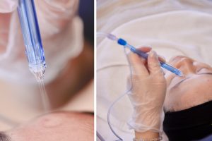 LIN-0230918A-這些醫美療程加速器你一定要認識！-06