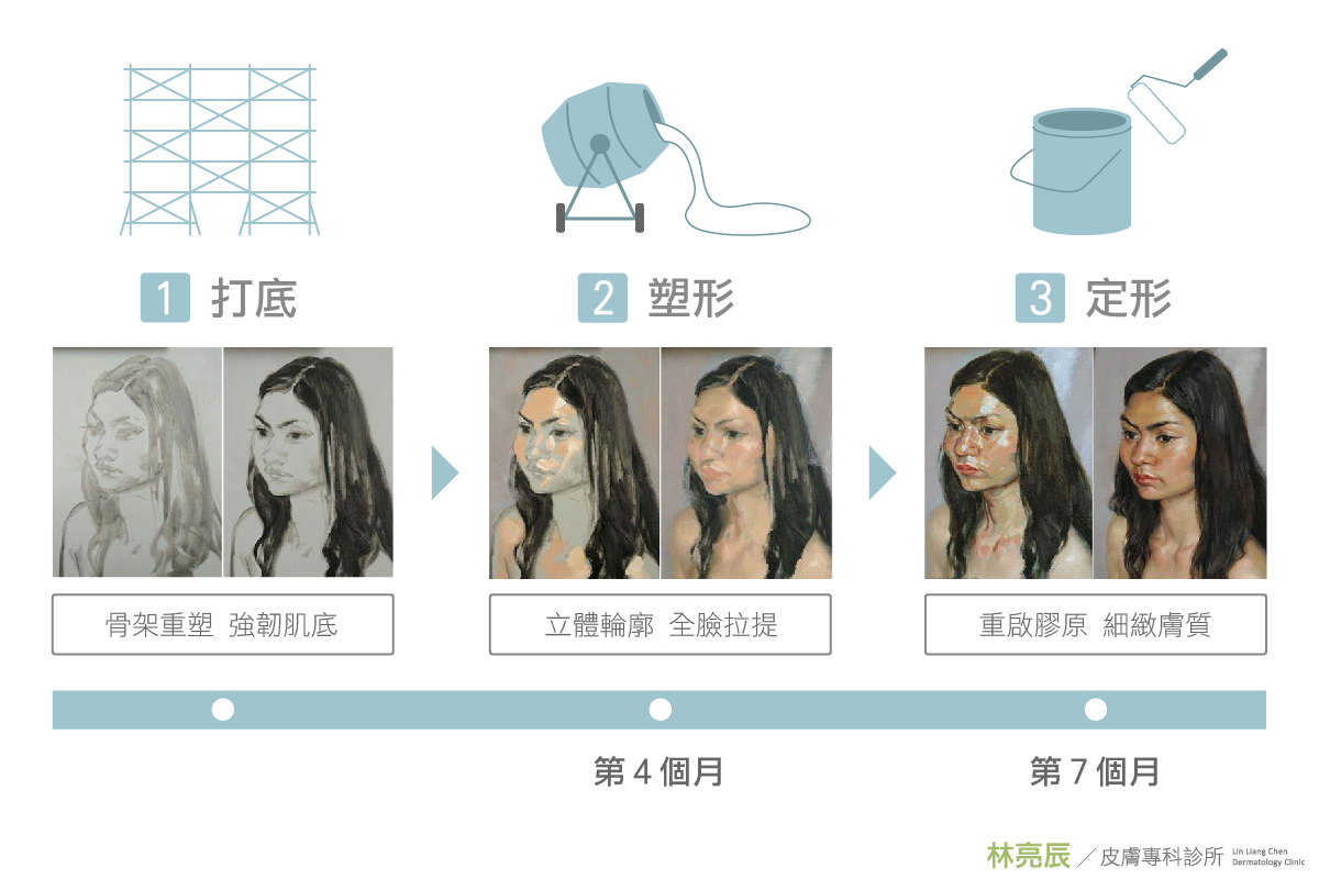 林亮辰醫師提出-舒顏萃4D童妍針減齡三部曲 分為打底塑形定形三個階段-
