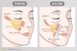 法令紋的出現與韌帶鬆弛有關