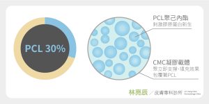 洢蓮絲少女針由PCL與CMC組成