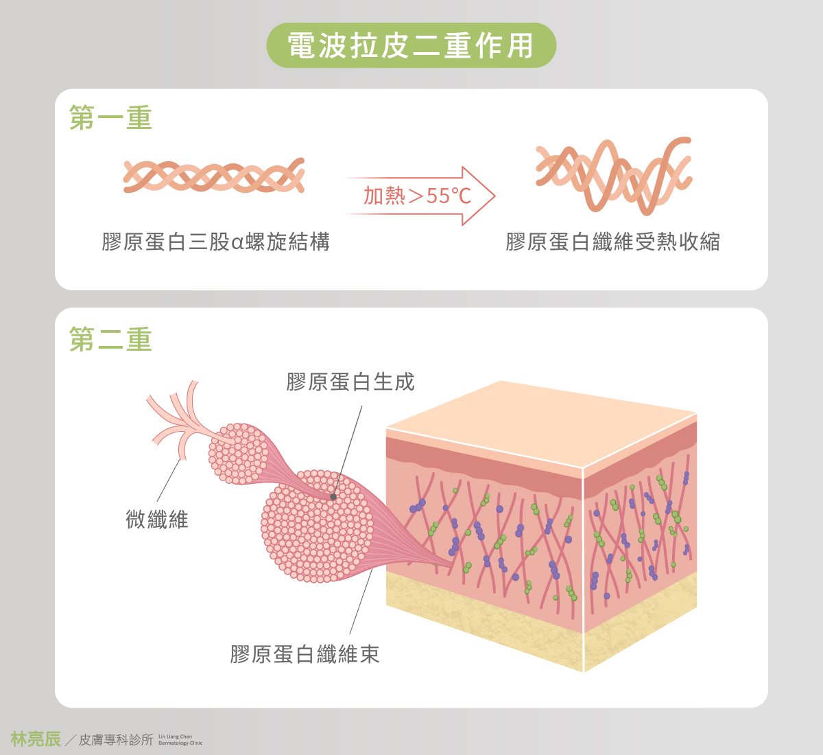 鳳凰電波施打後會有二重作用包含施打當下與後續新生膠原蛋白