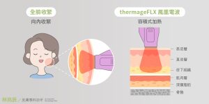 電波拉皮全層加熱皮膚收緊皮膚 可以些微改善法令紋但就只是些微