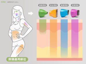 鳳凰電波不同探頭作用在不同深部因此適用不同部位而這些也會以想電波拉皮價格