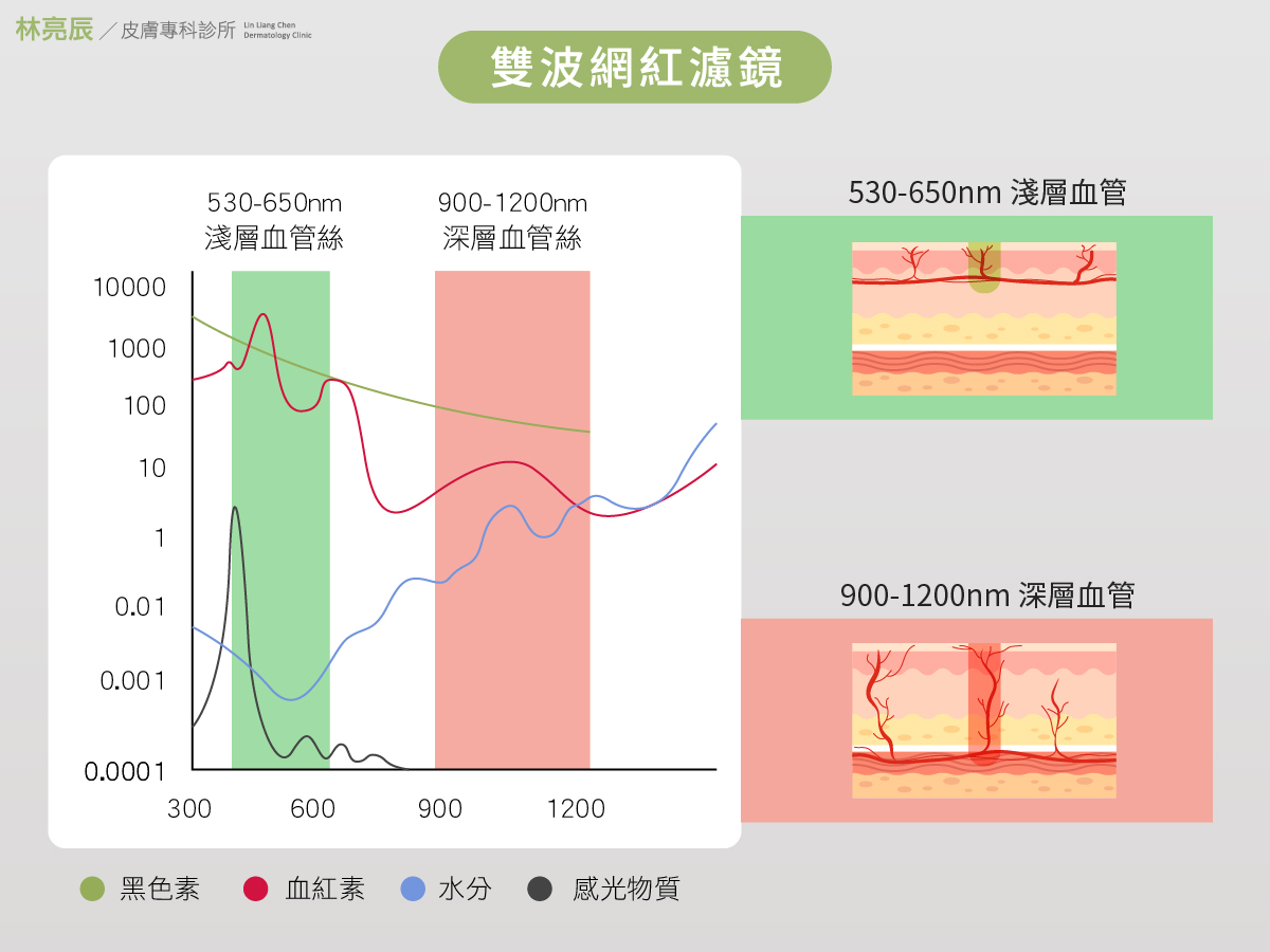 心動光的網紅血管濾片