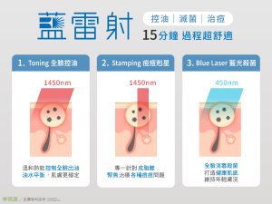 藍雷射可以控油滅菌輔助青春痘治療
