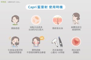 藍雷射可以改善皮脂腺出油適用於臉部頭皮背部
