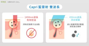 藍雷射擁有雙波長 1450 450nm