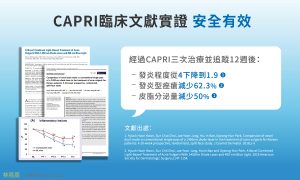 藍雷射被證實可以有效改善痘痘發炎