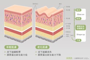 高德美的Shape upGlow on概念正與4D童顏針減齡三部曲相呼應