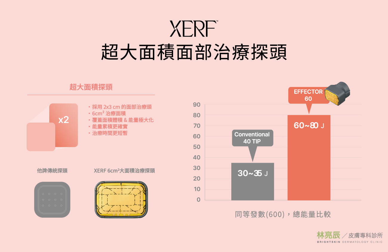 XERF 電波 6cm² 大面積治療探頭與傳統探頭的發數及總能量比較圖。