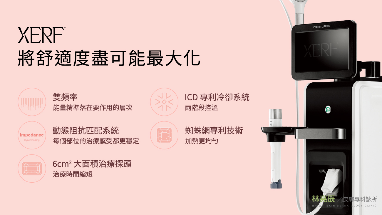 XERF 電波提升療程舒適度的五大核心技術總整理