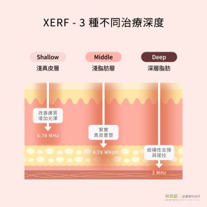 XERF 電波三種治療深度模式：淺真皮層、淺脂肪層與深層脂肪。