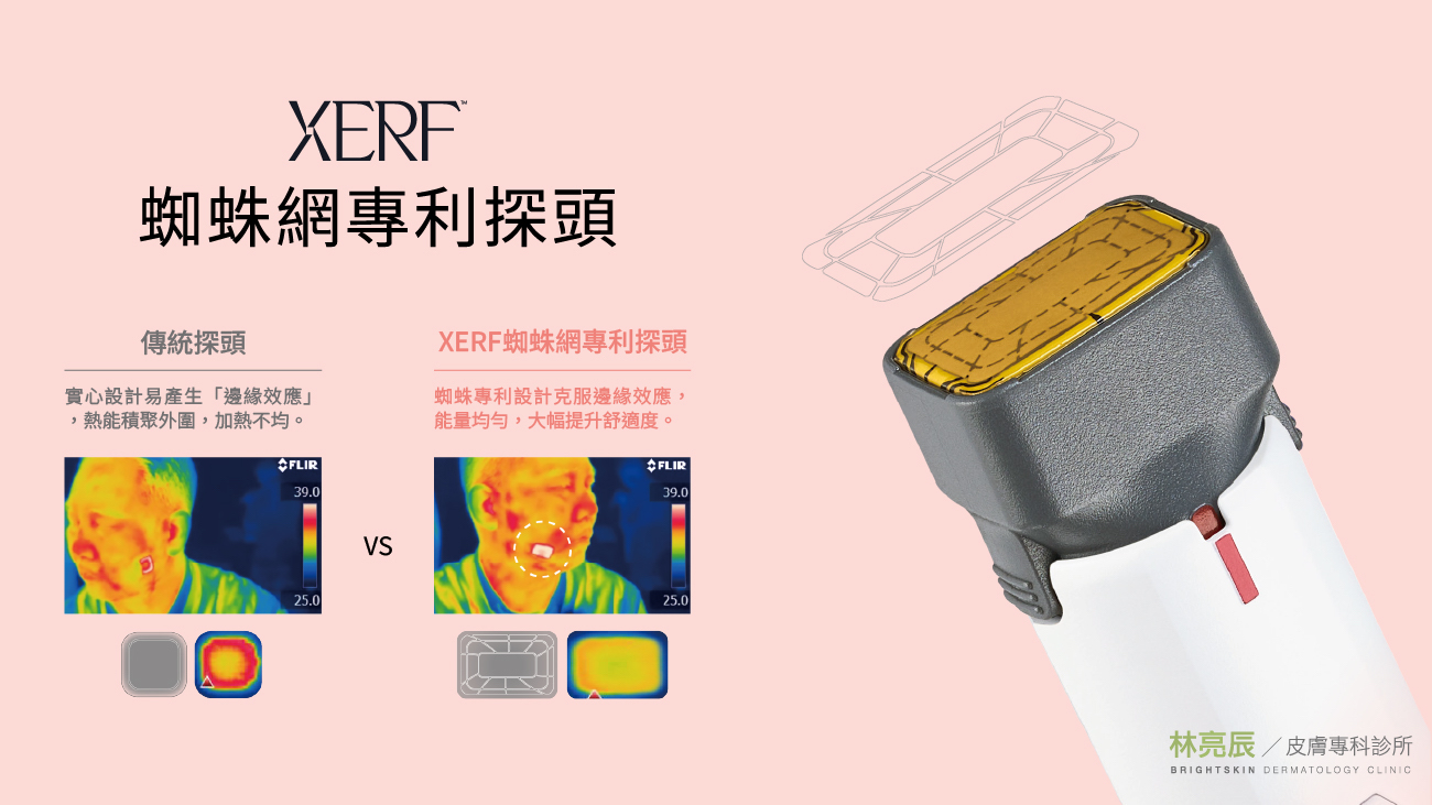 XERF 蜘蛛網專利探頭與傳統探頭熱顯像圖比較，顯示其加熱更為均勻。