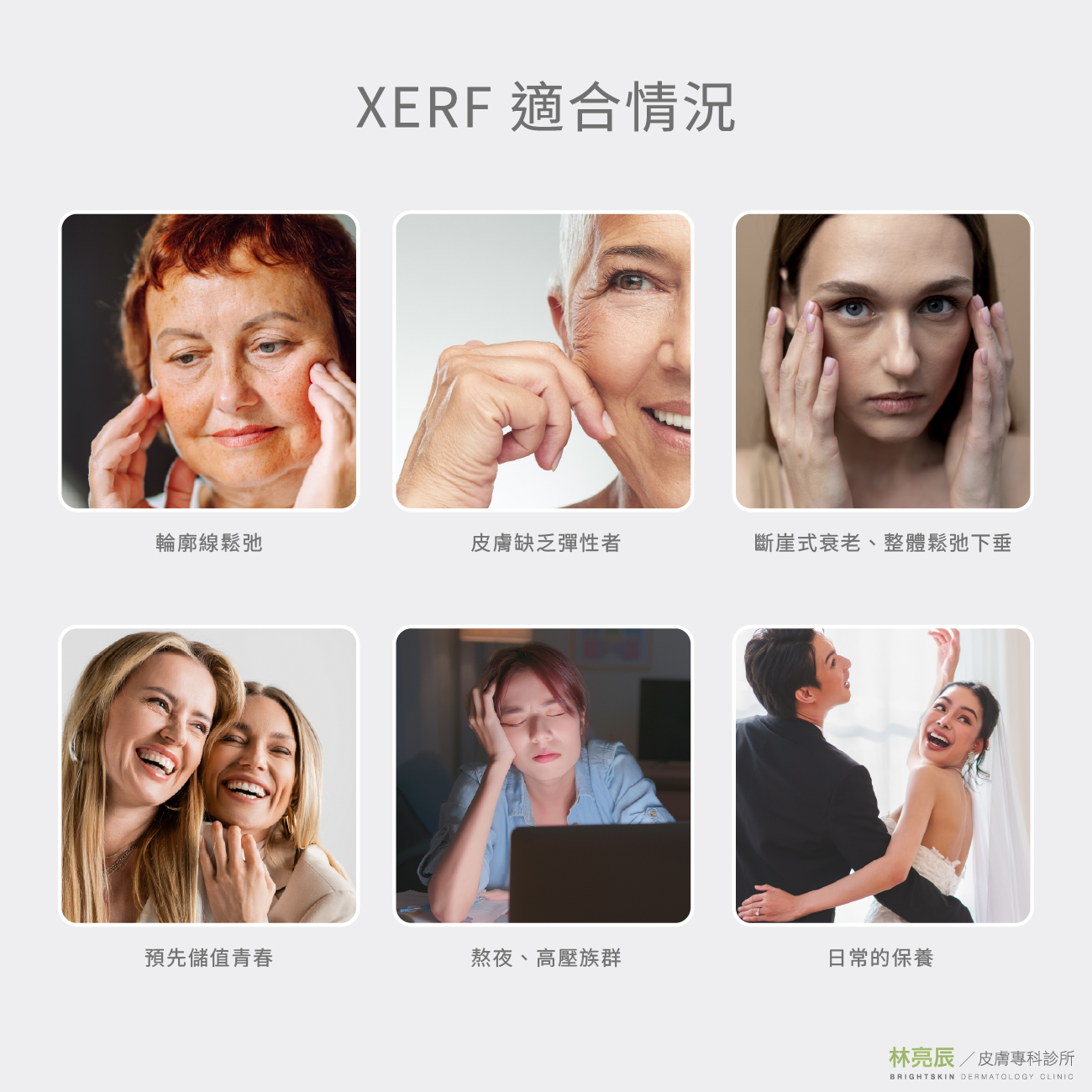 XERF 雙頻電波六大適合情況，包含輪廓線鬆弛、缺乏彈性與日常保養。
