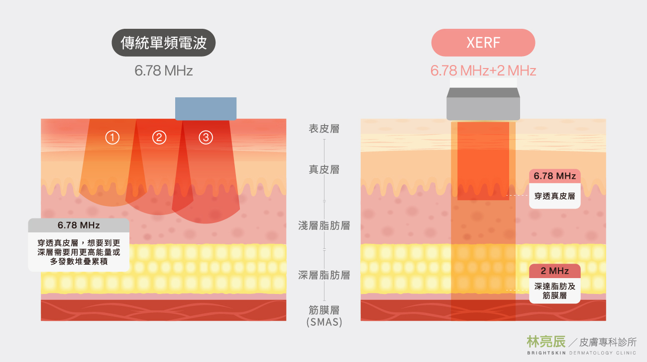 傳統單頻電波與 XERF 雙頻電波穿透深度比較圖，呈現 6.78 MHz 與 2 MHz 的差異。