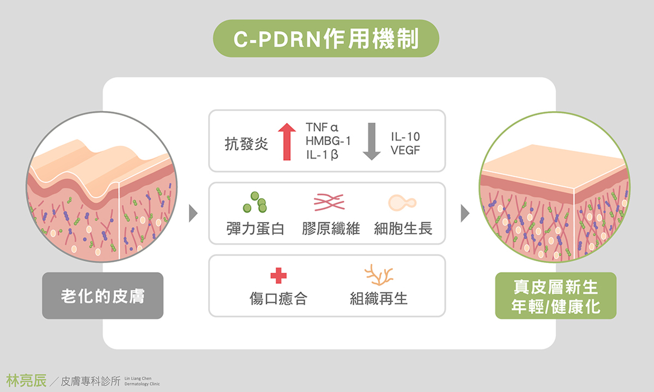 c-PDRN 作用機制圖解,說明其抗發炎、傷口癒合與促進真皮層新生之過程。