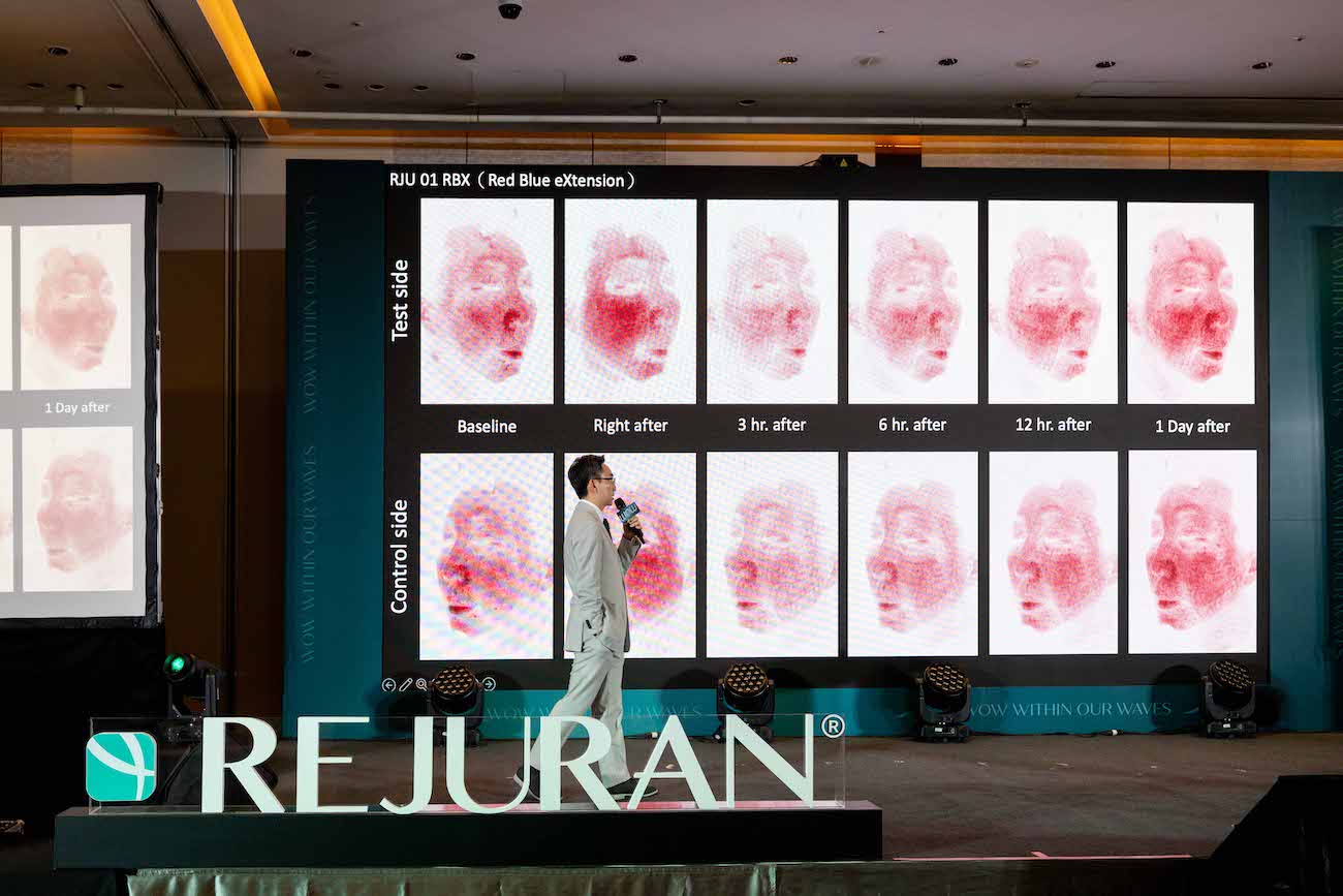 林亮辰醫師於專題演講中展示光電術後使用 PDRN 加速退紅的臨床數據圖表。
